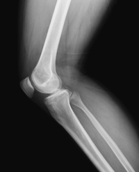 Radiografia da criança: morfologia perfeita, cartilagem nem tanto